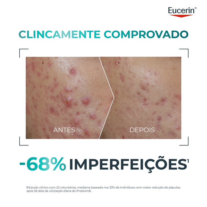 Eucerin DermoPure Clinical Probiom8 Rotina