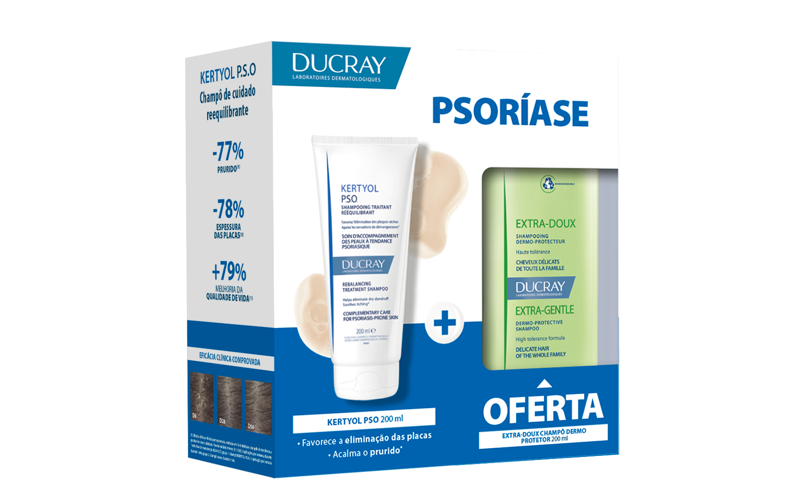 Ducray Kertyol PSO Champô - 200ml + Ofera Extra Doux Champô - 200ml